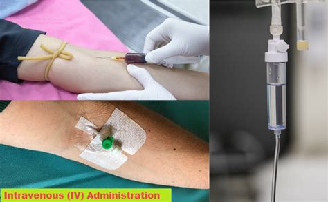 Intravenous injection: Uses, equipment, 